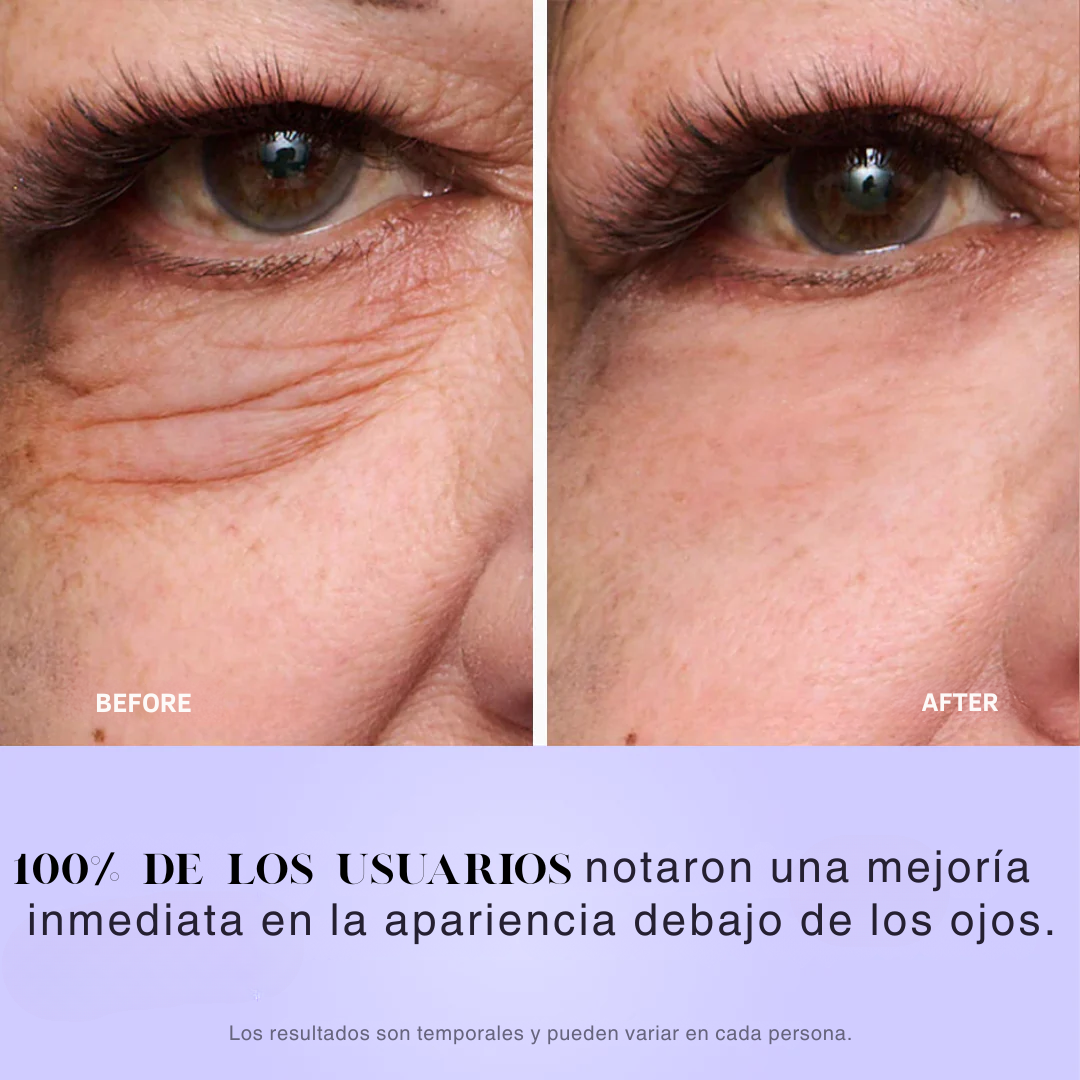 Blumyy™ Tensor Instantáneo de Ojeras
